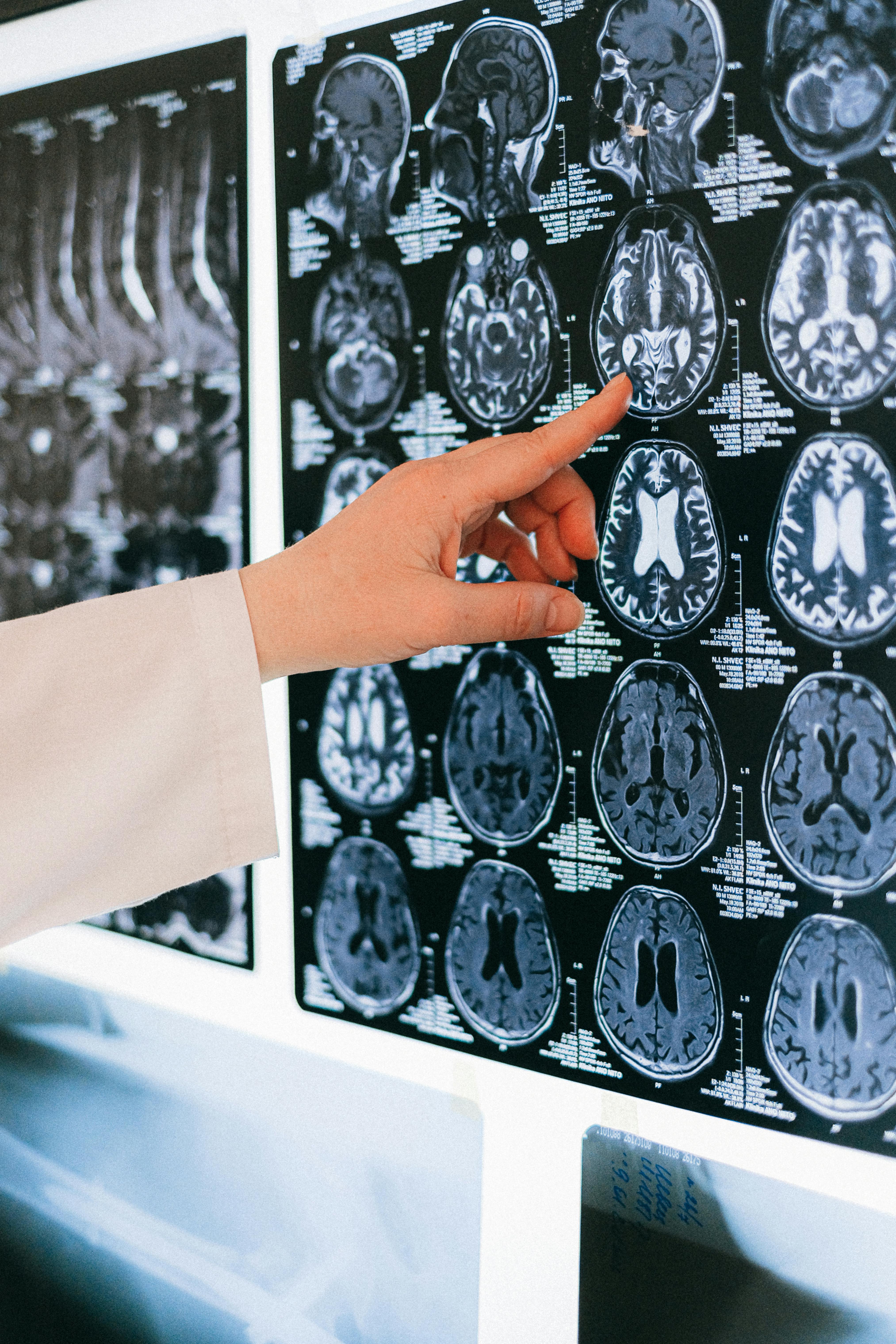 Masterclass: El cerebro