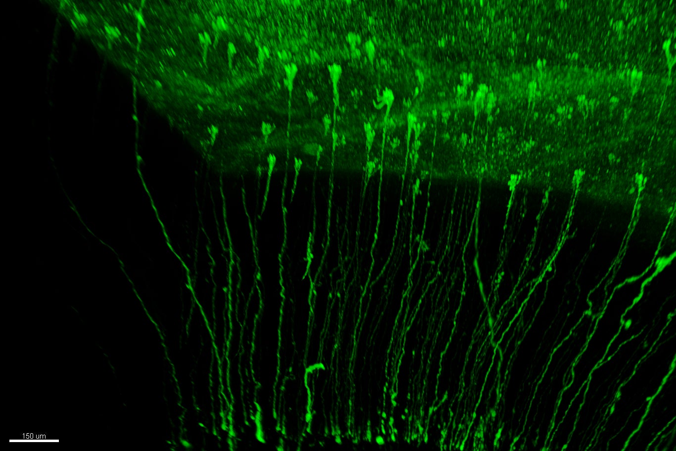 Un estudio de la UMH de Elche describe el proceso que hace que la corteza cerebral de los humanos sea mayor que la de otros animales Un estudio de la UMH de Elche describe el proceso que hace que la corteza cerebral de los humanos sea mayor que la de otros animales