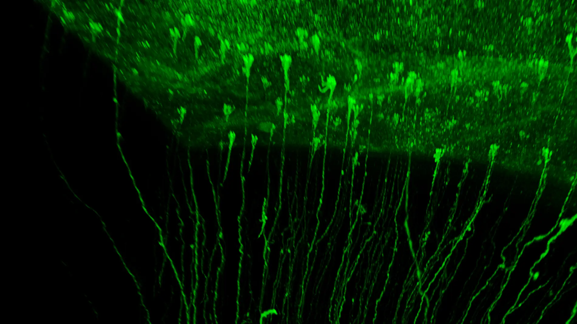 Diversidad de células Glia Radial en la corteza cerebral de hurón neonato, marcadas con proteína fluorescente verde y vistas dentro del cerebro transparentado.