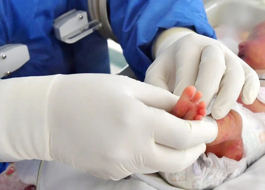 Navarra, por encima de la media nacional de los cribados neonatales Navarra, por encima de la media nacional de los cribados neonatales