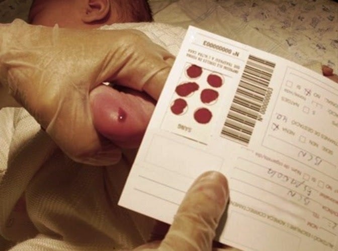 Qué enfermedades se detectan con el cribado neonatal o 'prueba del talón' Qué enfermedades se detectan con el cribado neonatal o 'prueba del talón'