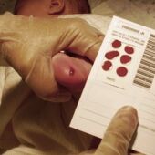 Qué enfermedades se detectan con el cribado neonatal o 'prueba del talón'