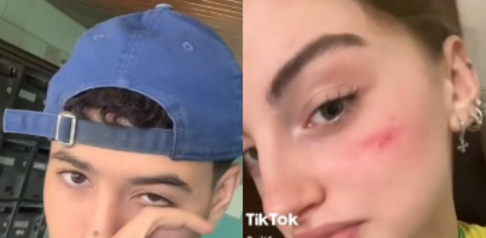 ¿Se puede reclamar a Tik Tok por los daños sufridos durante un reto viral? ¿Se puede reclamar a Tik Tok por los daños sufridos durante un reto viral?