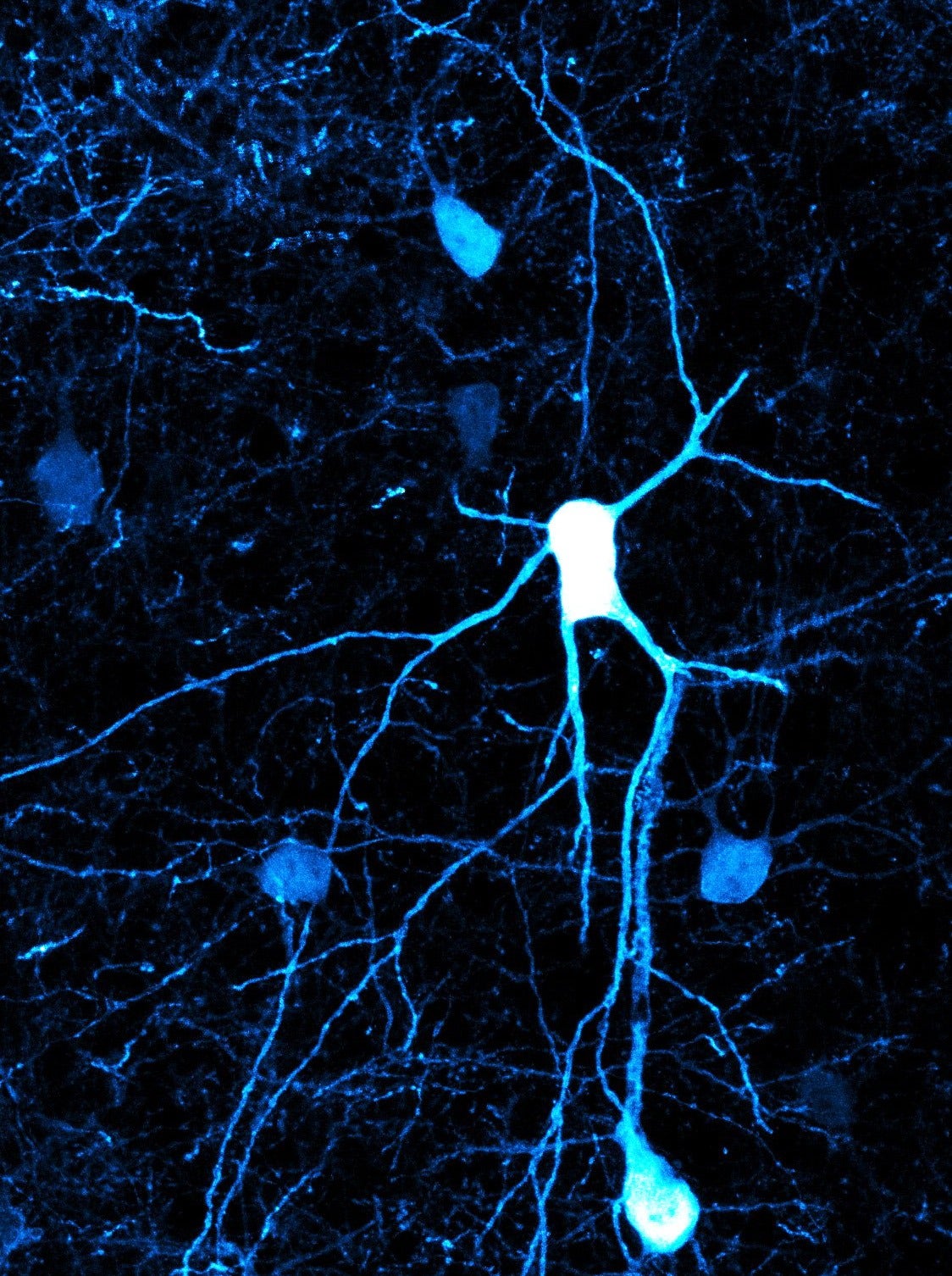 Investigadores del CSIC identifican la implicación de un tipo minoritario de neuronas en el desarrollo del cerebro Investigadores del CSIC identifican la implicación de un tipo minoritario de neuronas en el desarrollo del cerebro