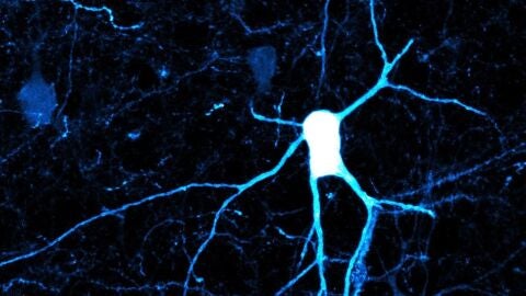 Investigadores del CSIC identifican la implicaci&oacute;n de un tipo minoritario de neuronas en el desarrollo del cerebro