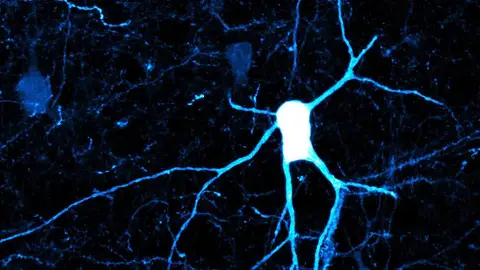 Investigadores del CSIC identifican la implicación de un tipo minoritario de neuronas en el desarrollo del cerebro Investigadores del CSIC identifican la implicación de un tipo minoritario de neuronas en el desarrollo del cerebro