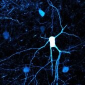 Investigadores del CSIC identifican la implicación de un tipo minoritario de neuronas en el desarrollo del cerebro