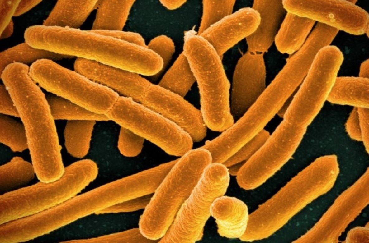 La OMS actualiza la lista de bacterias más resistentes y peligrosas para la salud: "La amenaza se ha intensificado" La OMS actualiza la lista de bacterias más resistentes y peligrosas para la salud: "La amenaza se ha intensificado"
