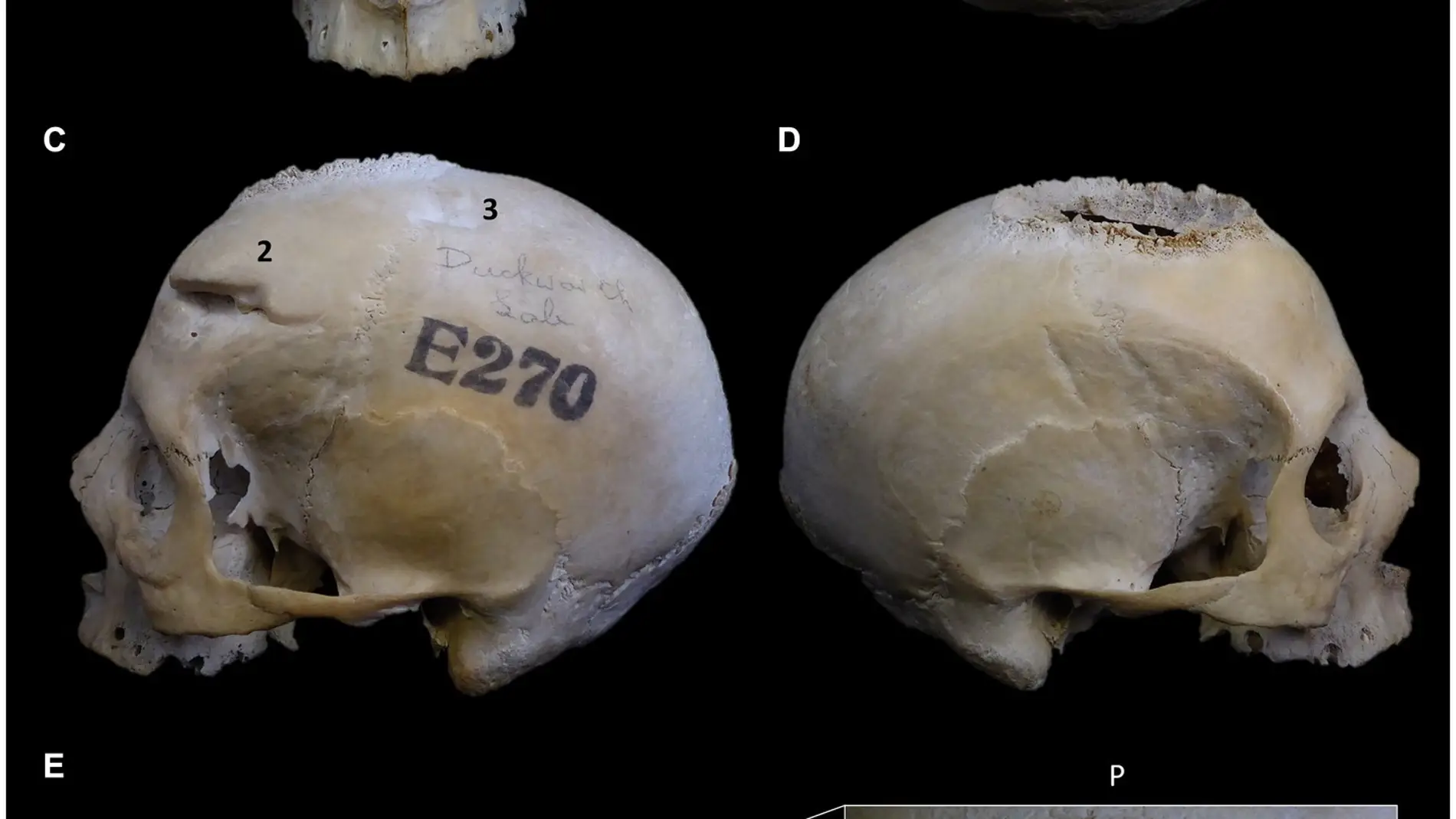 Imágenes de un cráneo egipcio de 4.000 años en el estudio publicado en 'Frontiers in Medicine'.