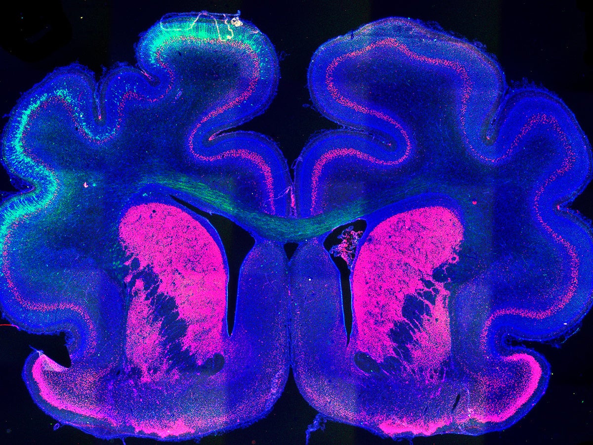Un estudio del Instituto de Neurociencias de la UMH de Elche halla el posible mecanismo que favorece que se produzcan pliegues en la corteza cerebral Un estudio del Instituto de Neurociencias de la UMH de Elche halla el posible mecanismo que favorece que se produzcan pliegues en la corteza cerebral