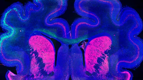 Imagen del cerebro de un hurón que muestra el patrón de plegamiento alterado (izquierda) por mediación de la proteína Cux2. Imagen del cerebro de un hurón que muestra el patrón de plegamiento alterado (izquierda) por mediación de la proteína Cux2.