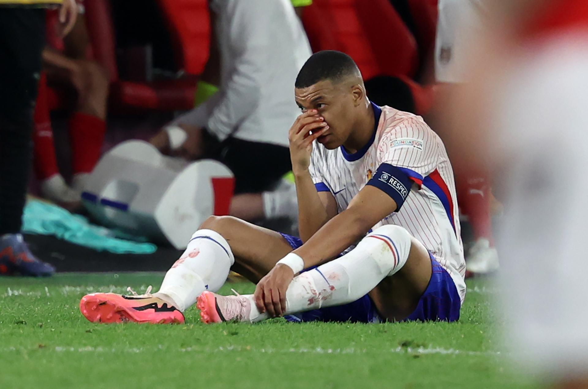 Mbappé se rompe la nariz en el debut de Francia en la Eurocopa Mbappé se rompe la nariz en el debut de Francia en la Eurocopa