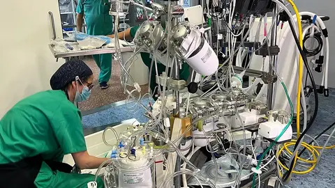 La compleja maquinaria que ha permitido que el corazón haya podido ser trasplantado La compleja maquinaria que ha permitido que el corazón haya podido ser trasplantado