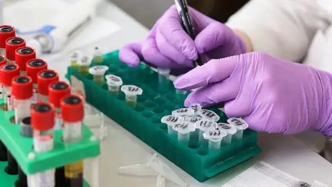 Una investigadora haciendo un análisis de sangre Una investigadora haciendo un análisis de sangre