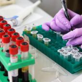 Una investigadora haciendo un análisis de sangre 