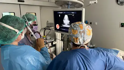 La técnica del crioEBUS ya es una realidad en el Hospital General de Castellón La técnica del crioEBUS ya es una realidad en el Hospital General de Castellón