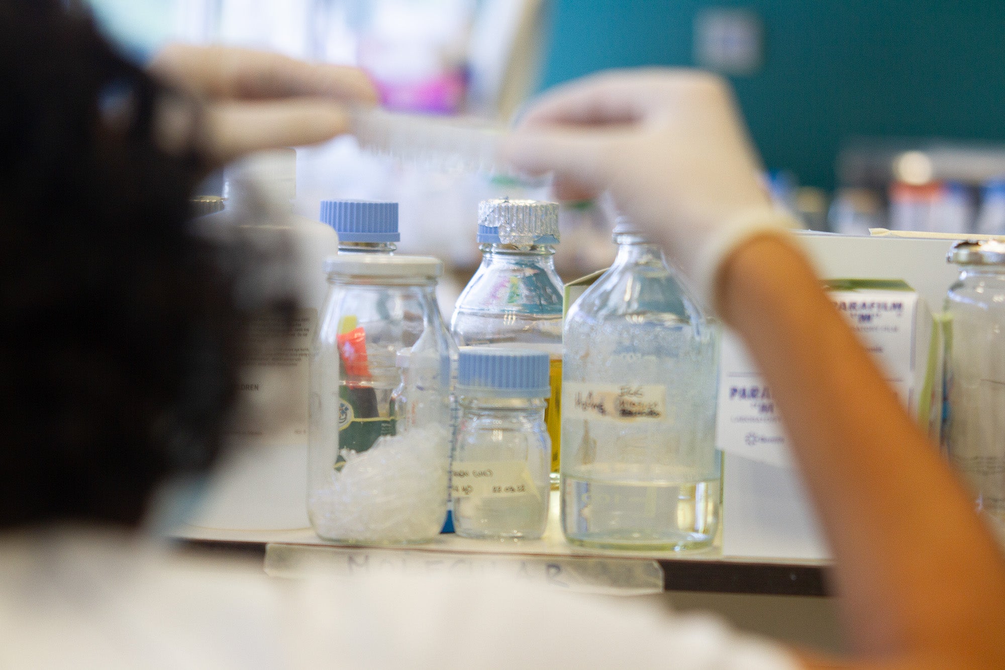 Proyecto Extremadura financiará estancias internacionales para jóvenes investigadores de ciencias de la vida y la salud Proyecto Extremadura financiará estancias internacionales para jóvenes investigadores de ciencias de la vida y la salud