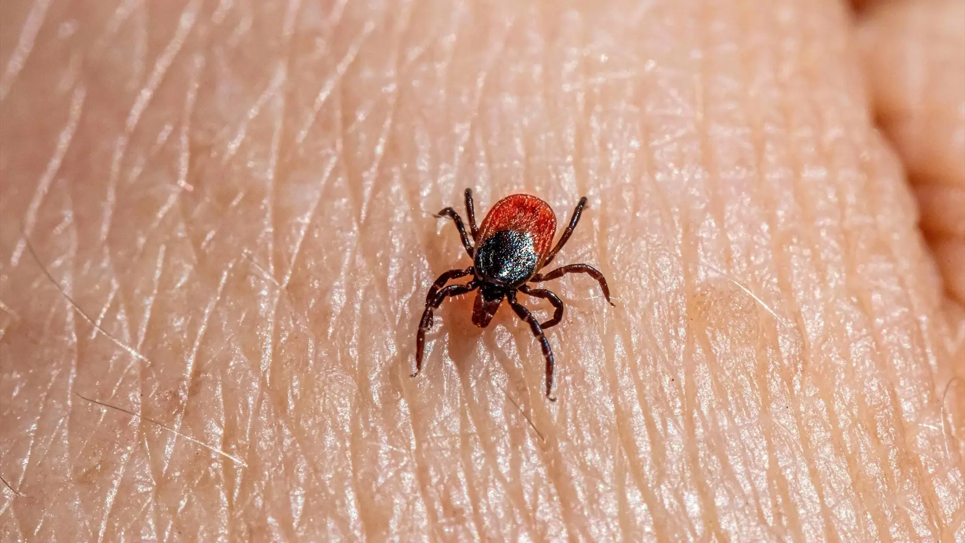 Muere en Madrid el hombre al que picó una garrapata y contrajo la fiebre Crimea-Congo Muere en Madrid el hombre al que picó una garrapata y contrajo la fiebre Crimea-Congo