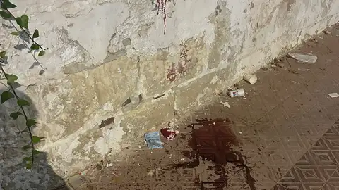 Restos de sangre como consecuencia de la agresión con cuchillo. Restos de sangre como consecuencia de la agresión con cuchillo.