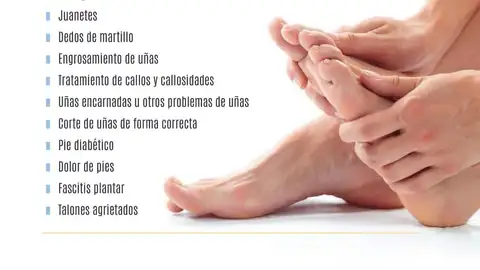 Los pies también se resienten en verano: estos son los consejos del Colegio de Podólogos en verano Los pies también se resienten en verano: estos son los consejos del Colegio de Podólogos en verano