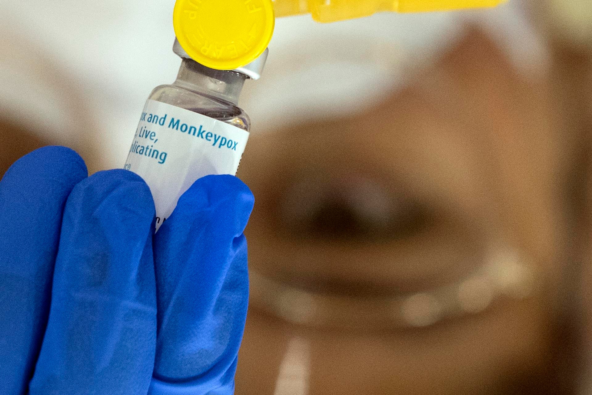 Suecia detecta el primer caso del actual brote de viruela del mono fuera de África Suecia detecta el primer caso del actual brote de viruela del mono fuera de África