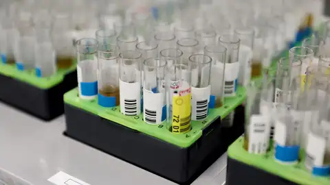 Probetas de pruebas PCR en el Laboratorio de Microbiología del Hospital público Gregorio Marañón, a 31 de mayo de 2022, en Madrid (España). El centro hospitalario, junto a otros cuatro en la región, ha comenzado a realizar pruebas PCR para la vi Probetas de pruebas PCR en el Laboratorio de Microbiología del Hospital público Gregorio Marañón, a 31 de mayo de 2022, en Madrid (España). El centro hospitalario, junto a otros cuatro en la región, ha comenzado a realizar pruebas PCR para la vi