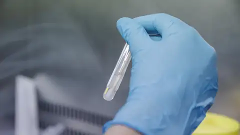 Una técnico de laboratorio sostiene una de las pruebas de análisis para la viruela del mono, en el Hospital Ramón y Cajal, a 30 de mayo de 2022, en Madrid (España) - Carlos Luján Una técnico de laboratorio sostiene una de las pruebas de análisis para la viruela del mono, en el Hospital Ramón y Cajal, a 30 de mayo de 2022, en Madrid (España) - Carlos Luján