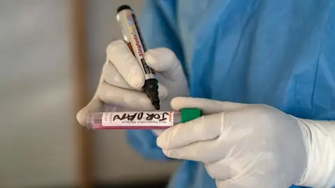 Un miembro del personal médico etiqueta una muestra de mpox tomada de un paciente en el Centro de Salud de Munigi, en Munigi, República Democrática del Congo, el 19 de agosto de 2024. EFE/EPA/Moise Kasereka Un miembro del personal médico etiqueta una muestra de mpox tomada de un paciente en el Centro de Salud de Munigi, en Munigi, República Democrática del Congo, el 19 de agosto de 2024. EFE/EPA/Moise Kasereka