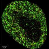Imagen microscópica de una célula cancerosa 