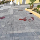 Sangre del herido en la Vila Joisoa Sangre del herido en la Vila Joisoa