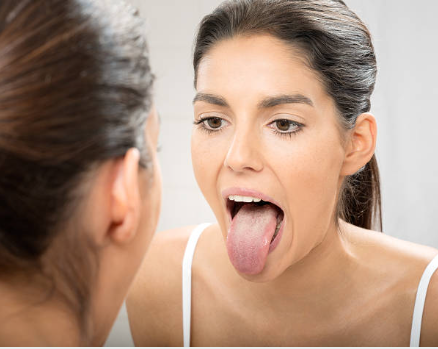 Por qué a veces tengo la lengua blanca: estas pueden ser las causas, según los sanitarios Por qué a veces tengo la lengua blanca: estas pueden ser las causas, según los sanitarios