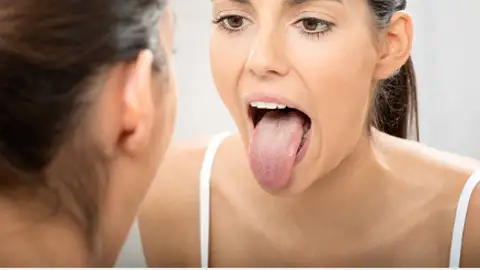 Por qué a veces tengo la lengua blanca: estas pueden ser las causas, según los sanitarios Por qué a veces tengo la lengua blanca: estas pueden ser las causas, según los sanitarios