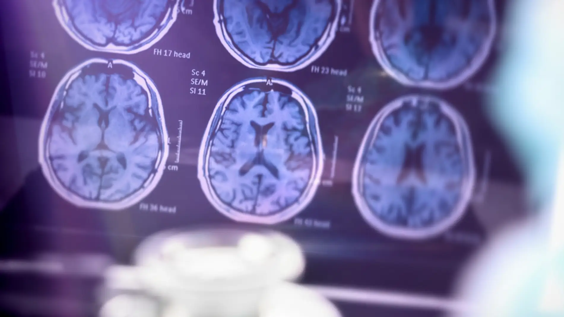 Día Mundial del Alzhéimer Día Mundial del Alzhéimer