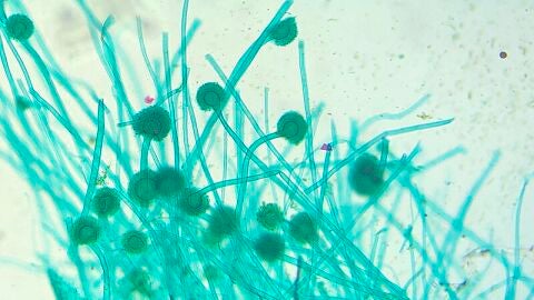 Imagen de archivo del hongo Aspergillus.