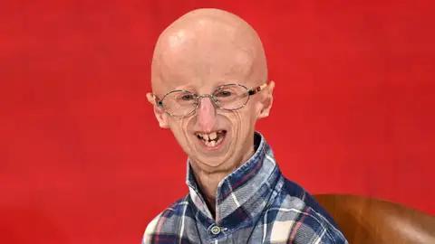Muere a los 28 años Sammy Basso, el científico que visibilizó el síndrome del envejecimiento relámpago Muere a los 28 años Sammy Basso, el científico que visibilizó el síndrome del envejecimiento relámpago