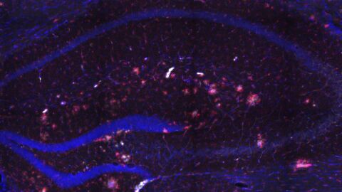 El Instituto de Neurociencias de la UMH de Elche estudiar&aacute; el papel de la microgl&iacute;a en la enfermedad de Alzheimer.