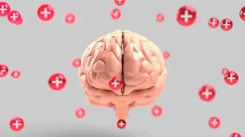 Cerebro Cerebro