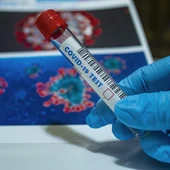 Imagen de archivo de un test de Covid-19. Imagen de archivo de un test de Covid-19.