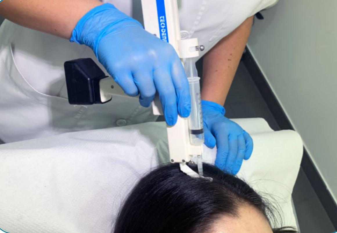 Dr. García: "Lo peor de la alopecia es dejarlo pasar, hay que tratarla desde los primeros síntomas" Dr. García: "Lo peor de la alopecia es dejarlo pasar, hay que tratarla desde los primeros síntomas"