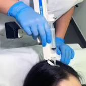 Alopecia Alopecia