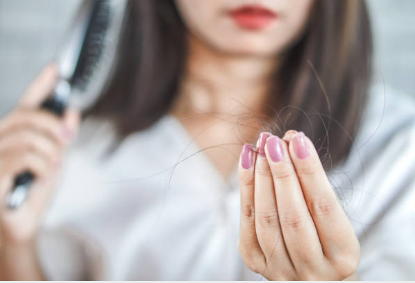 Por qué se me cae tanto el pelo: los dermatólogos alertan de las posibles causas Por qué se me cae tanto el pelo: los dermatólogos alertan de las posibles causas