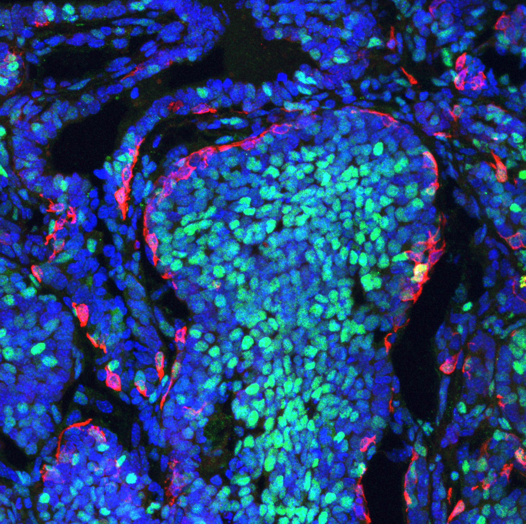 Un estudio de la UMH de Elche revela que las células cancerosas compiten a favor y en contra del desarrollo de un tumor Un estudio de la UMH de Elche revela que las células cancerosas compiten a favor y en contra del desarrollo de un tumor