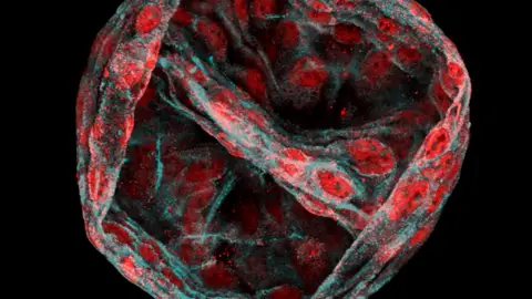 Organoide de células pluripotentes humanas del colon Organoide de células pluripotentes humanas del colon