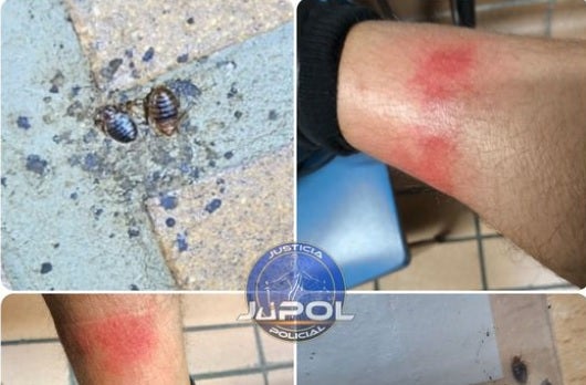 Piden el cierre de los calabozos de la Comisaría Provincial por una plaga de chinches que arrastran desde hace tres años Piden el cierre de los calabozos de la Comisaría Provincial por una plaga de chinches que arrastran desde hace tres años