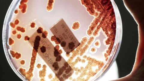 bacterias resistentes a antibióticos bacterias resistentes a antibióticos