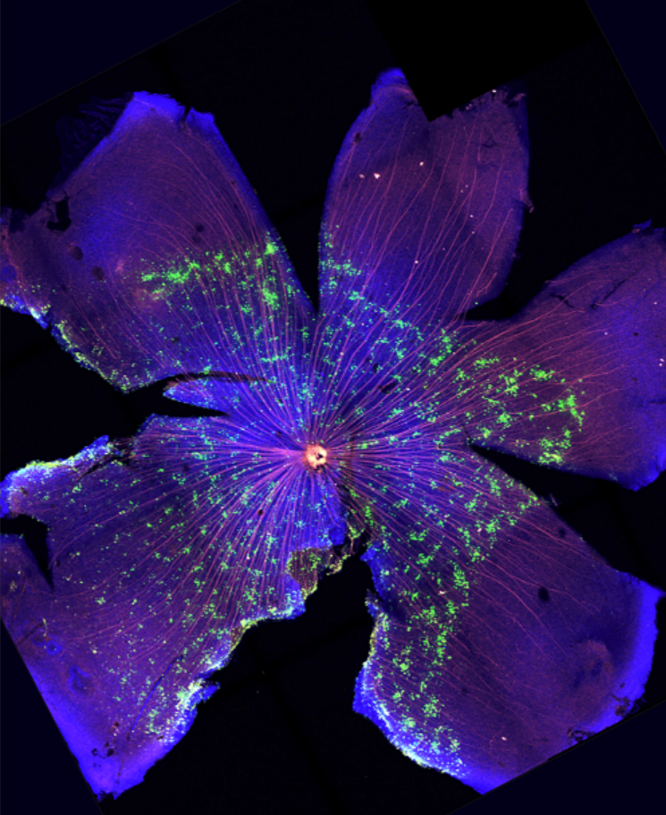 El Instituto de Neurociencias de la UMH de Elche identifica el papel que juega una proteína en el desarrollo del sistema visual El Instituto de Neurociencias de la UMH de Elche identifica el papel que juega una proteína en el desarrollo del sistema visual