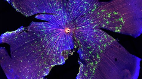 Retina de rat&oacute;n donde se observan las c&eacute;lulas ganglionares que sobreexpresan EphA4 formando agregados (verde) y sus axones marcados en rojo, fundamentales para la correcta conectividad del sistema visual.