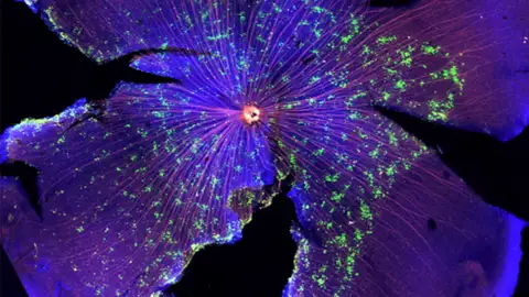 Retina de ratón donde se observan las células ganglionares que sobreexpresan EphA4 formando agregados (verde) y sus axones marcados en rojo, fundamentales para la correcta conectividad del sistema visual. Retina de ratón donde se observan las células ganglionares que sobreexpresan EphA4 formando agregados (verde) y sus axones marcados en rojo, fundamentales para la correcta conectividad del sistema visual.