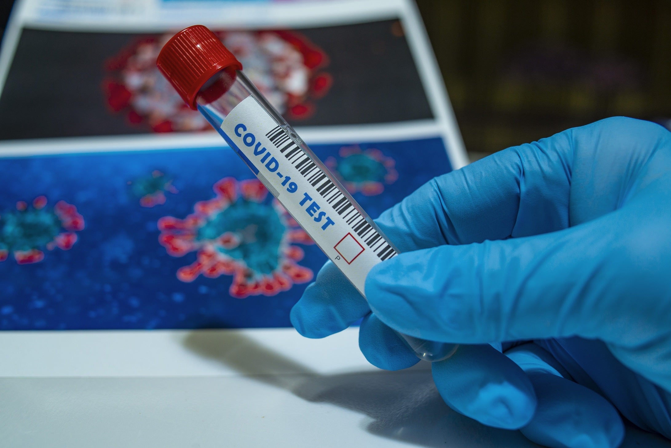 ¿Virus de laboratorio gracias a la IA? ¿Virus de laboratorio gracias a la IA?