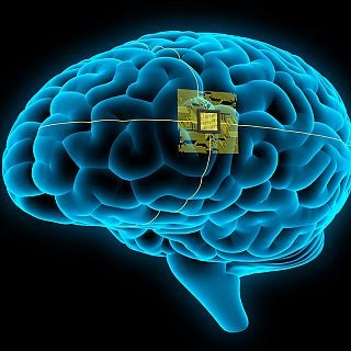 No es magia es ciencia: El implante cerebral que traduce pensamientos en habla No es magia es ciencia: El implante cerebral que traduce pensamientos en habla